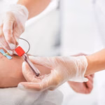 Fotografía Médica De Primer Plano En Formato Horizontal Con Enfoque Selectivo. Se Muestran Las Manos De Un Profesional De La Salud Utilizando Guantes Quirúrgicos De Látex Transparentes Mientras Realiza Una Extracción De Sangre En El Brazo De Un Paciente. Con Una Mano Estabiliza La Aguja Tipo Mariposa Sujeta Con Una Banda Elástica Roja Al Brazo, Mientras Que Con La Otra Sostiene Con Precisión Un Tubo De Ensayo De Laboratorio Con Tapón Rojo Que Se Va Llenando Con Una Muestra De Sangre.