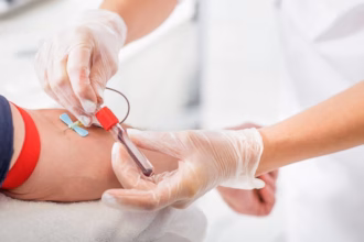 Fotografía Médica De Primer Plano En Formato Horizontal Con Enfoque Selectivo. Se Muestran Las Manos De Un Profesional De La Salud Utilizando Guantes Quirúrgicos De Látex Transparentes Mientras Realiza Una Extracción De Sangre En El Brazo De Un Paciente. Con Una Mano Estabiliza La Aguja Tipo Mariposa Sujeta Con Una Banda Elástica Roja Al Brazo, Mientras Que Con La Otra Sostiene Con Precisión Un Tubo De Ensayo De Laboratorio Con Tapón Rojo Que Se Va Llenando Con Una Muestra De Sangre.