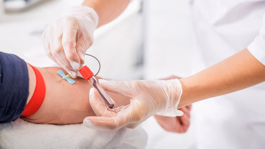 ¡Extiende Tus Brazos Por México! Todo Lo Que Necesitas Saber Sobre El 2Do Maratón Nacional De Donación De Sangre Altruista En Tabasco 70 Fotografía Médica De Primer Plano En Formato Horizontal Con Enfoque Selectivo. Se Muestran Las Manos De Un Profesional De La Salud Utilizando Guantes Quirúrgicos De Látex Transparentes Mientras Realiza Una Extracción De Sangre En El Brazo De Un Paciente. Con Una Mano Estabiliza La Aguja Tipo Mariposa Sujeta Con Una Banda Elástica Roja Al Brazo, Mientras Que Con La Otra Sostiene Con Precisión Un Tubo De Ensayo De Laboratorio Con Tapón Rojo Que Se Va Llenando Con Una Muestra De Sangre.